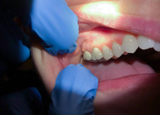 Best Emergency Dental Care for Broken or Chipped Teeth in Baldwin, FL