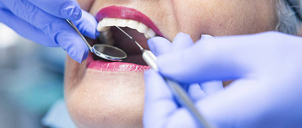 Best Urgent Care for Lost Fillings or Crowns in Baldwin, FL