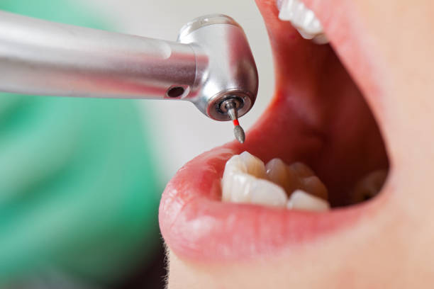 Best Emergency Denture Repair in Baldwin, FL